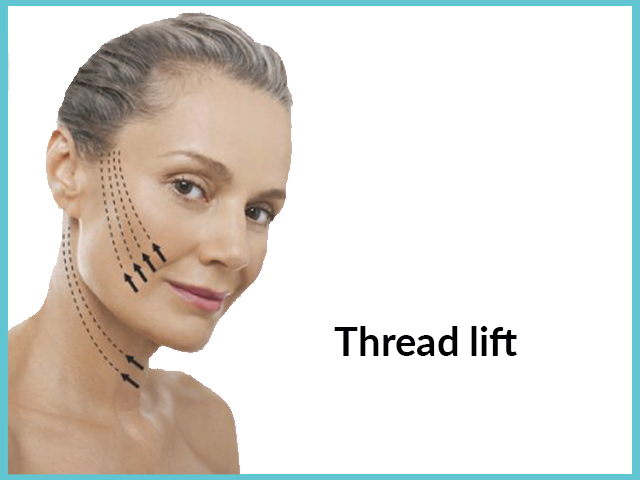 Laser Fat Removal – Thread Lift